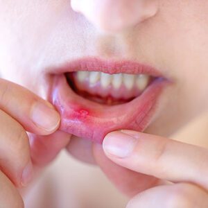 Dental Blog