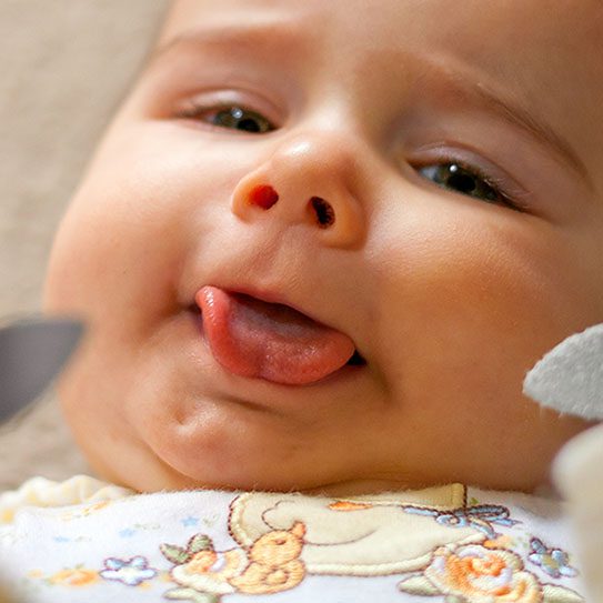 Lip and Tongue Ties: A Guide for Parents